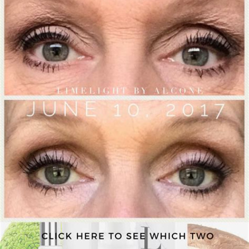 Best Eye Treatment For Crepey Eyelids Reviews