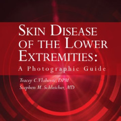 GET EPUB 💓 Skin Disease of the Lower Extremities: A Photographic Guide by  Stephen M