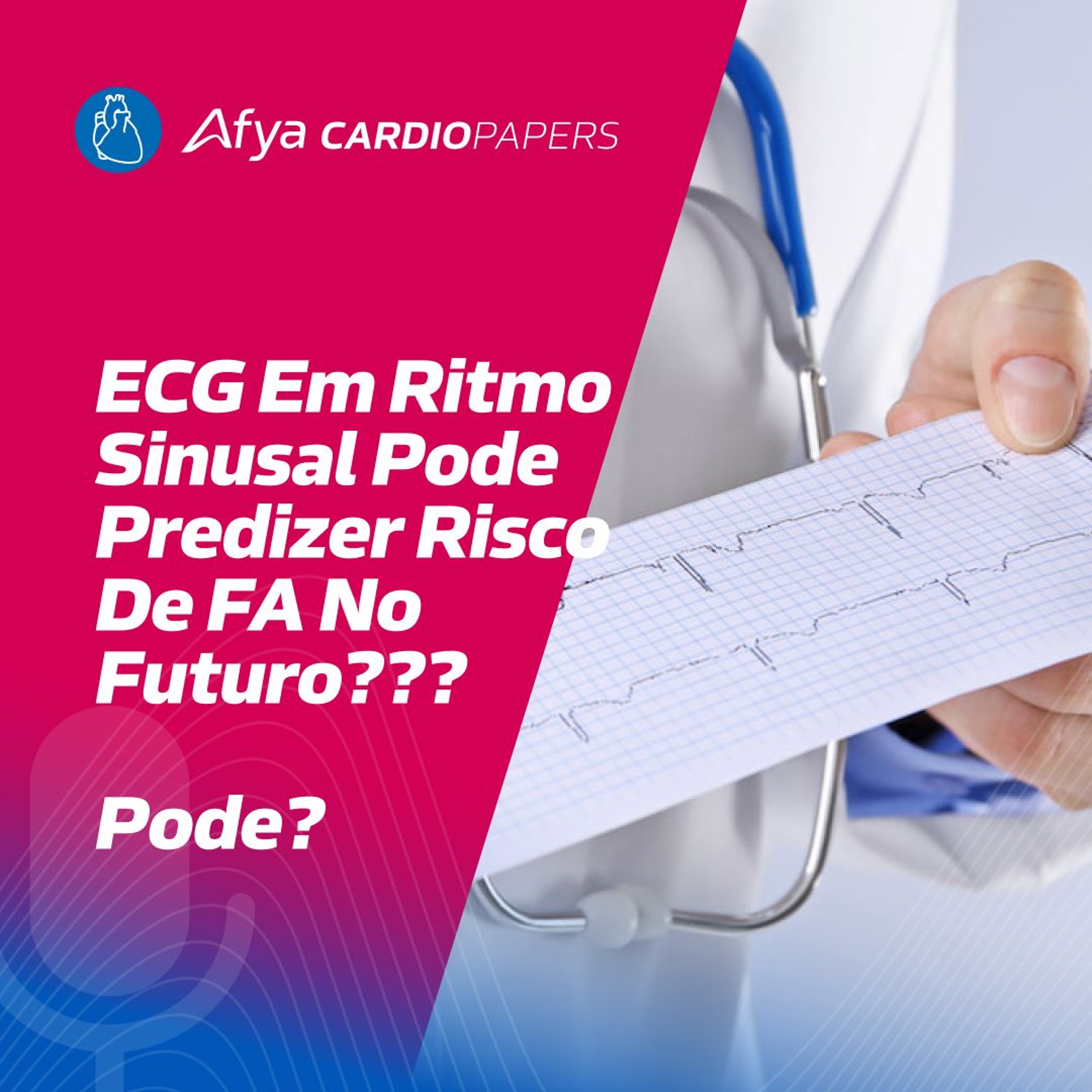 ECG em ritmo sinusal pode predizer risco de FA no futuro??? episode artwork