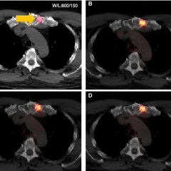 Deep Learning-based Whole-body Prostate-specific Membrane Antigen PET/CT Attenuation Correction