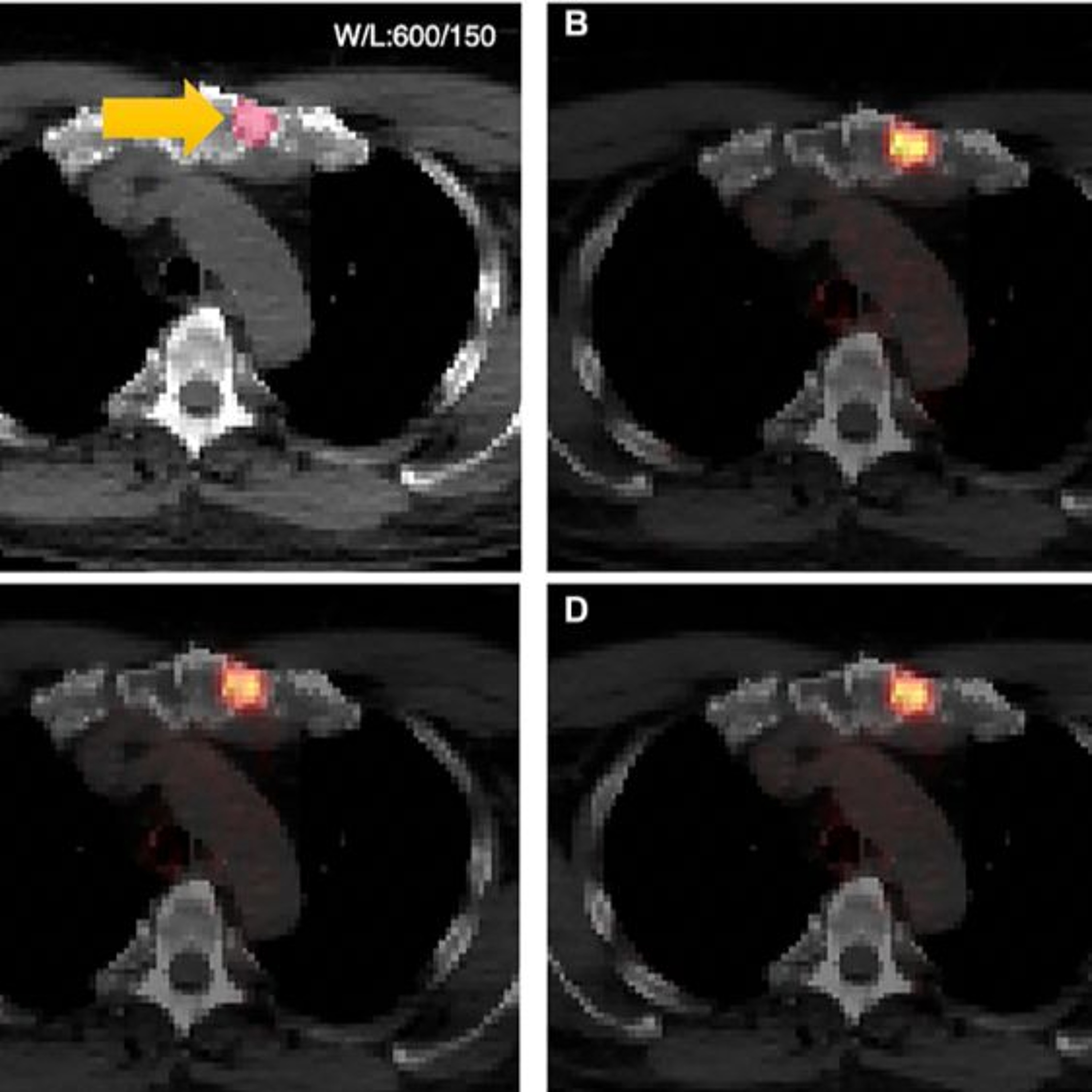Oncotarget