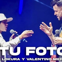 tu foto( q lokura y valentino merlo)