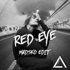 Justin Bieber - Red Eye (Madsko Edit) || BUY = FREE DL