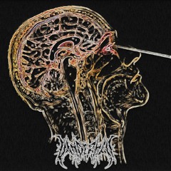 TEK - LOBOTOMY (VANDERHELL REMIX)