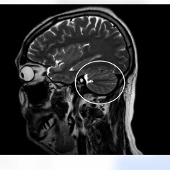 Geminiani: aus dem good taste in the art of musick, "Auld Bob Morrice"