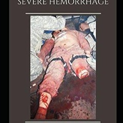 FULL✔READ️⚡(PDF) Treatment of Severe Hemorrhage