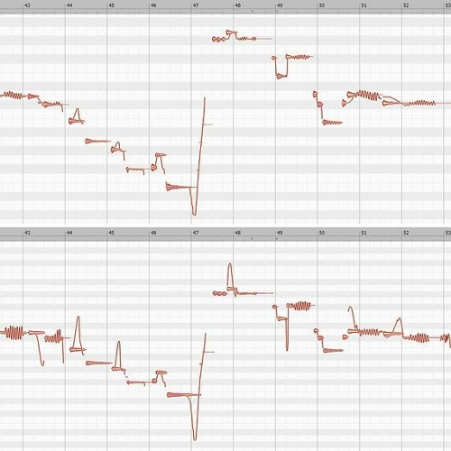 Melodyne Advanced Techniques \/\/TOP\\\\