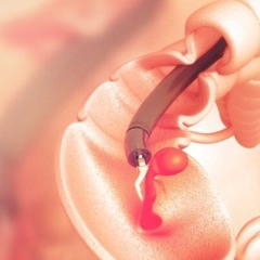 La Colonoscopía como herramienta de diagnóstico de los sistemas gastrointestinales