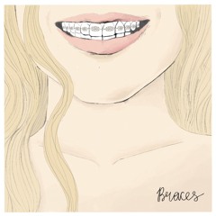Braces