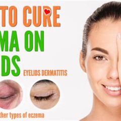 Best Contact Dermatitis Around Eyes Treatment Reviews