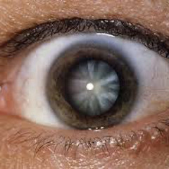 thomas-mraz ft.-boulevard-depo - glaucoma