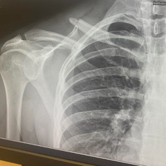 COLLAR BONE (FREE BANDCAMP DOWNLOAD)