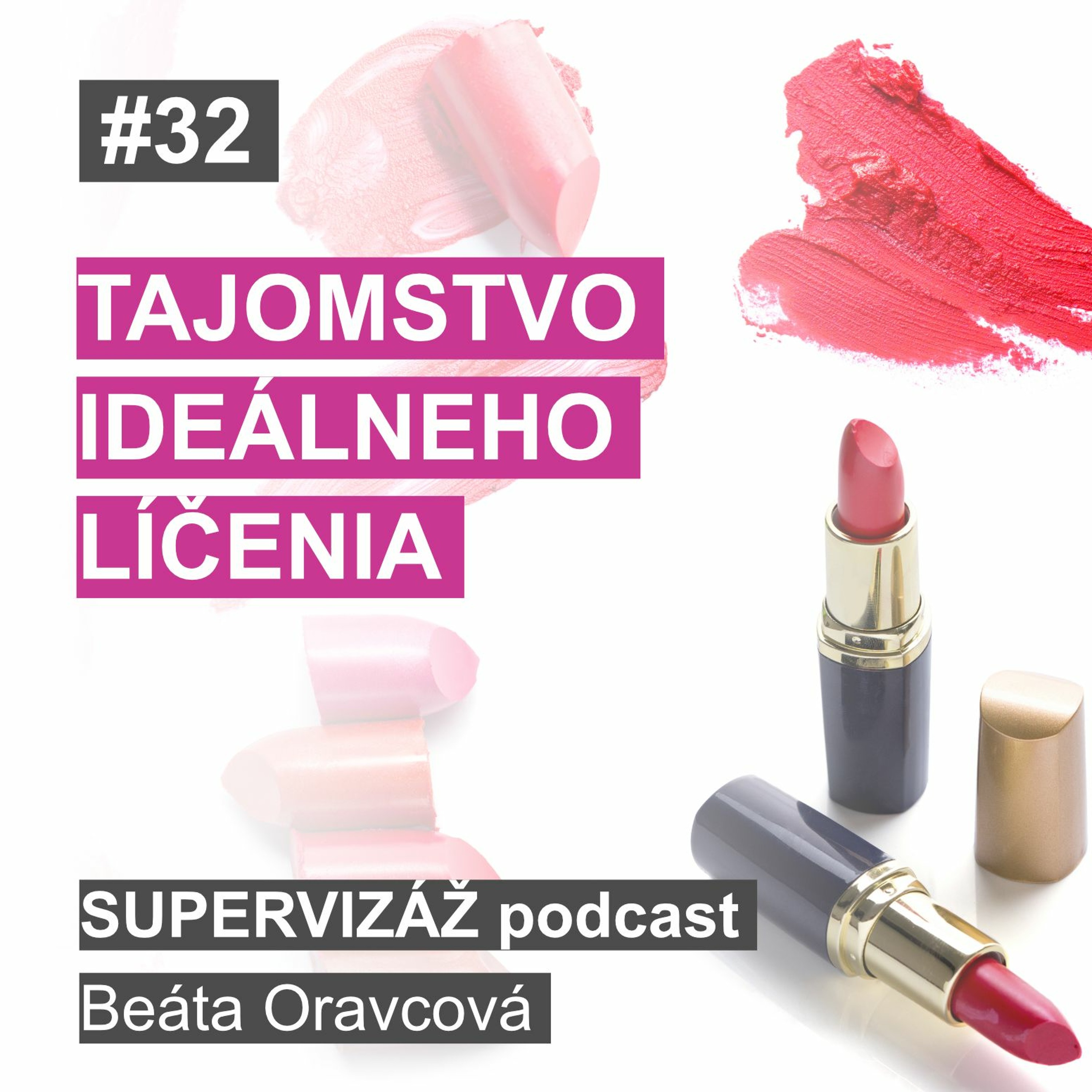 Supervizáž