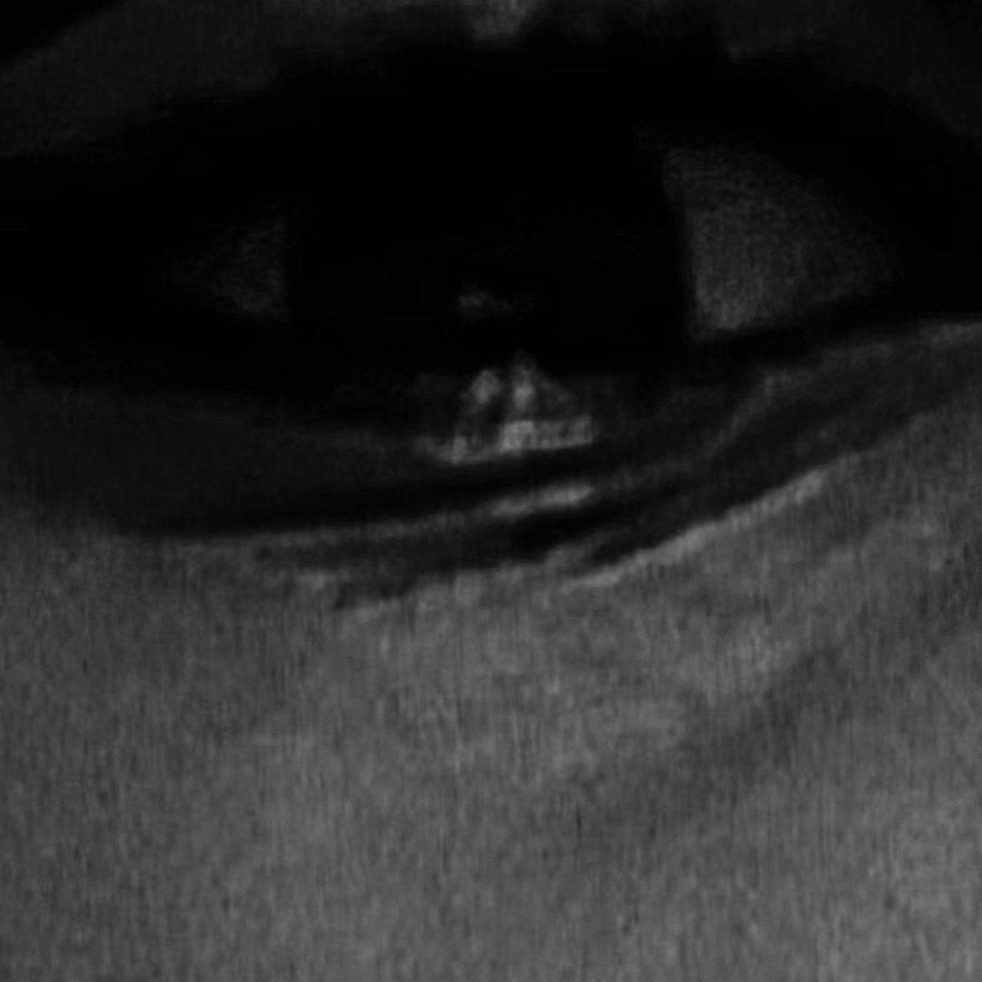EYE