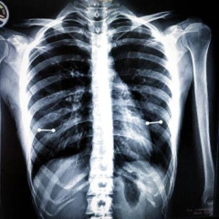 нужен сон (glorykeyz, thorns)