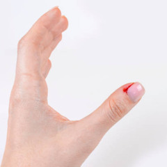near + smlx - cuticle (rayx)