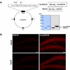 Tat-Heat Shock Protein 10 Ameliorates Age-Related Phenotypes in the Hippocampus