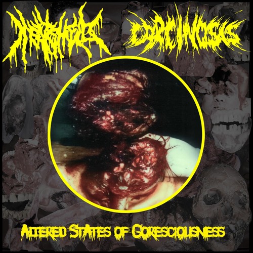 Stream 3 Post Sex Autopsy by Meatshield Listen online for  
