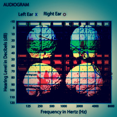 High Volume Load