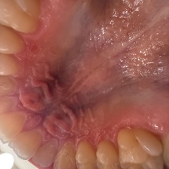 Gaussian Blur - July 2025 (Leftfield Bass)