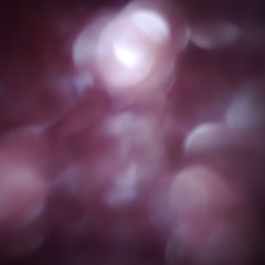 Bellview