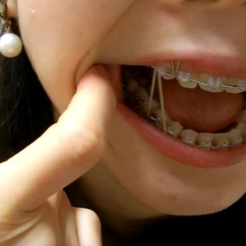 Braceface! prod. mattmode