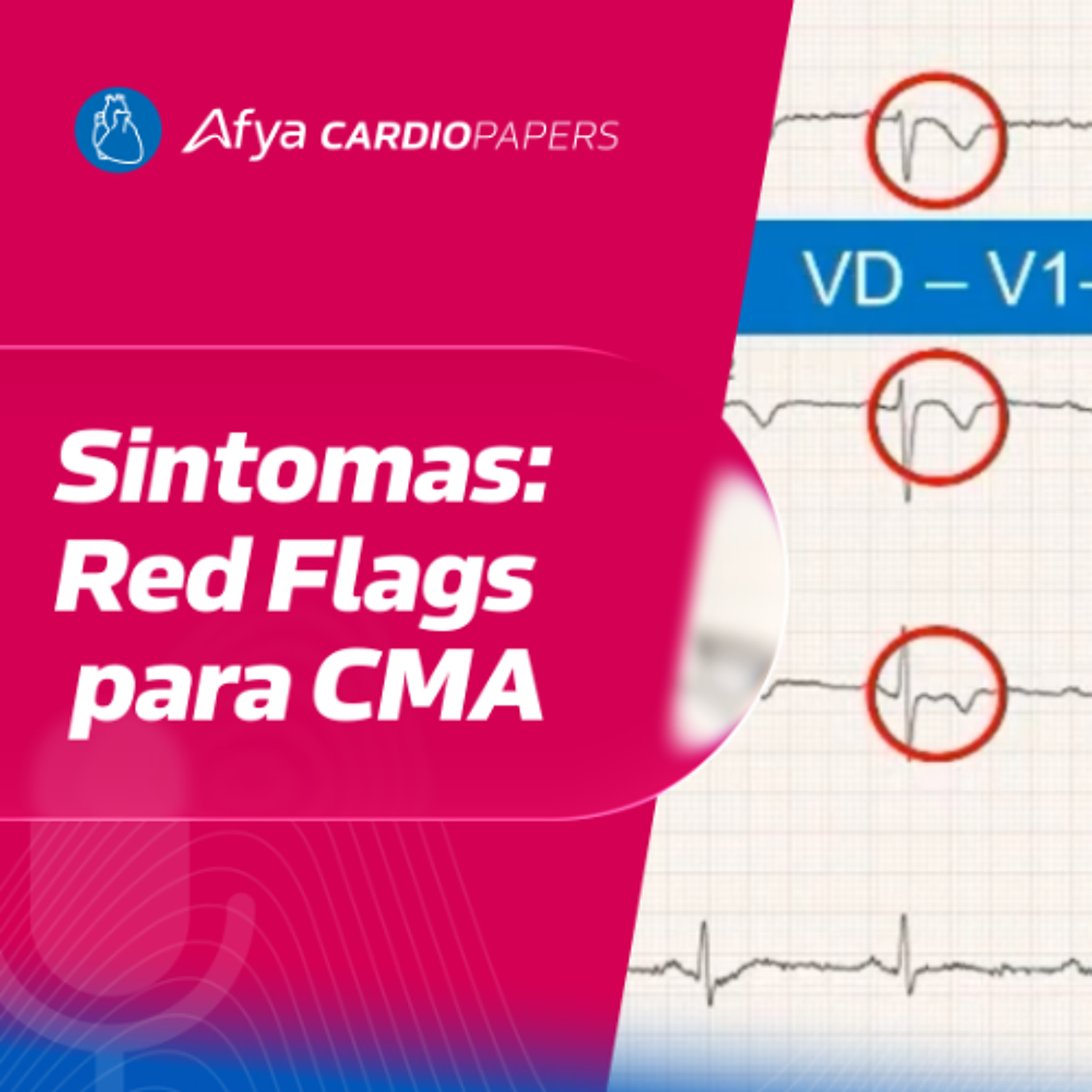 As Manifestações Clínicas da Cardiomiopatia Arritmogênica