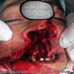 SMASHED ACROSS THE FACE WITH A PITCHFORK