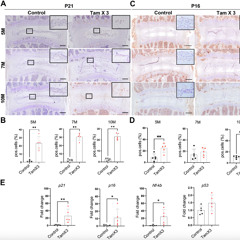 Overactive Runx1 Gene Triggers Early Disc Degeneration Linked to Aging