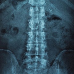 BACKBONE