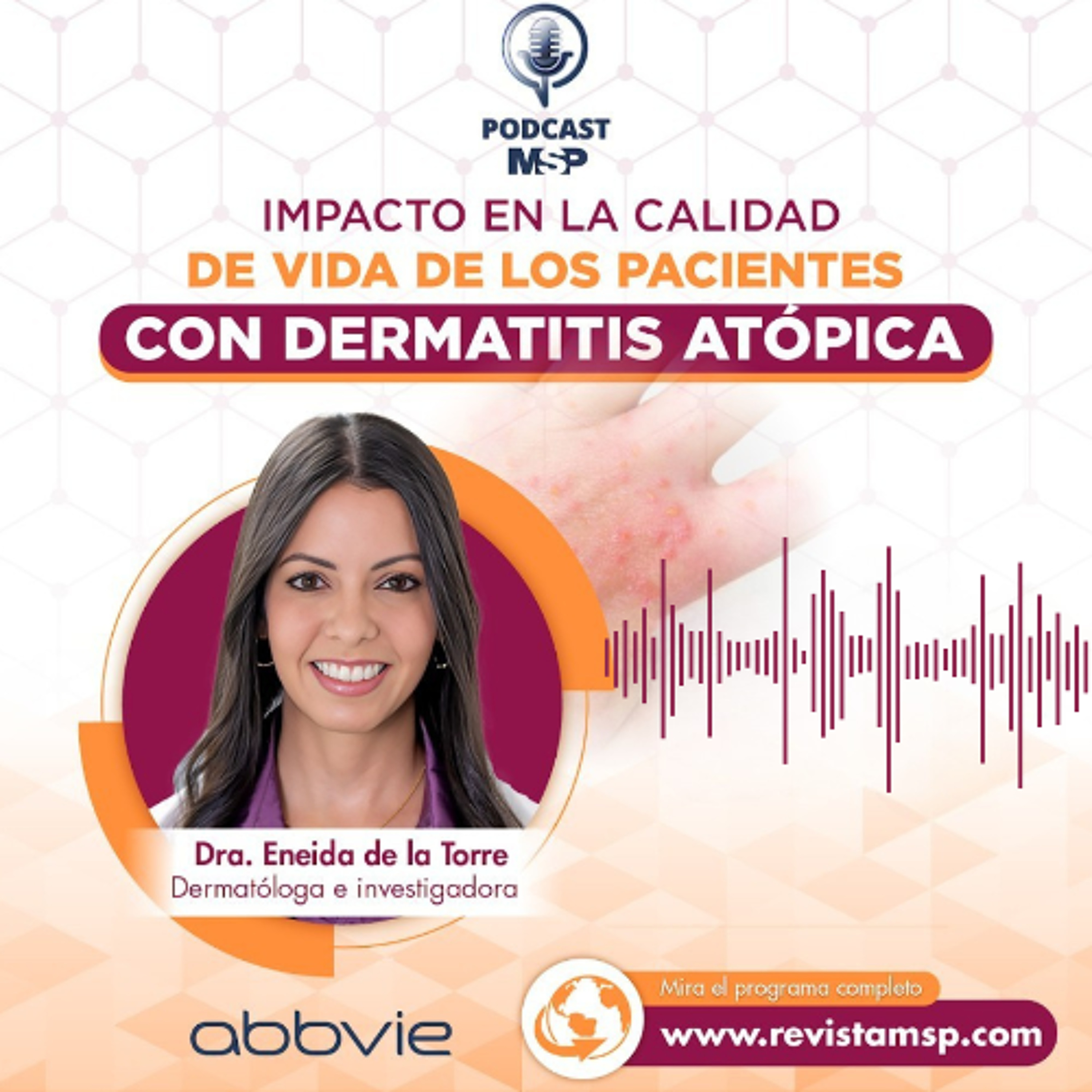 Podcast - Impacto en la calidad de vida de los pacientes con dermatitis atópica episode artwork