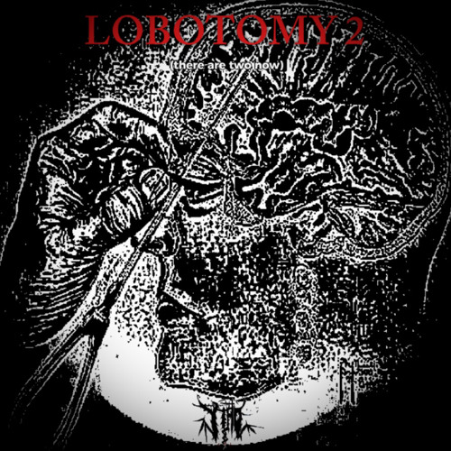 LOBOTOMY 2