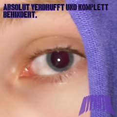 Absolut Verdrufft und komplett Behindert. [190er]