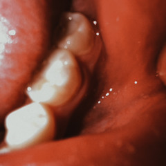 mouthbreather
