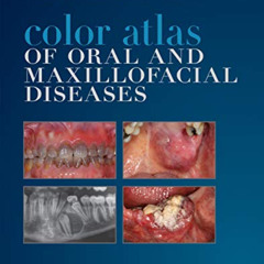 free KINDLE 📦 Color Atlas of Oral and Maxillofacial Diseases - E-Book by  Brad W. Ne