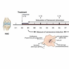 DNA Damage-induced Senescence Model in Osteoarthritic Chondrocytes