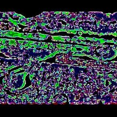 HRE-327136-CT (exsanguinated_2009bleed4U) _ {{downcast}}