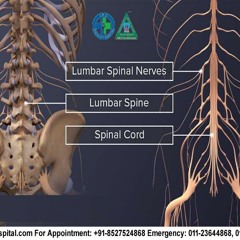 Spine Specialist In New Delhi Fix Lumbago By New Techniques