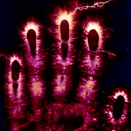 LOS - Metagene Factor - 07.22.2022