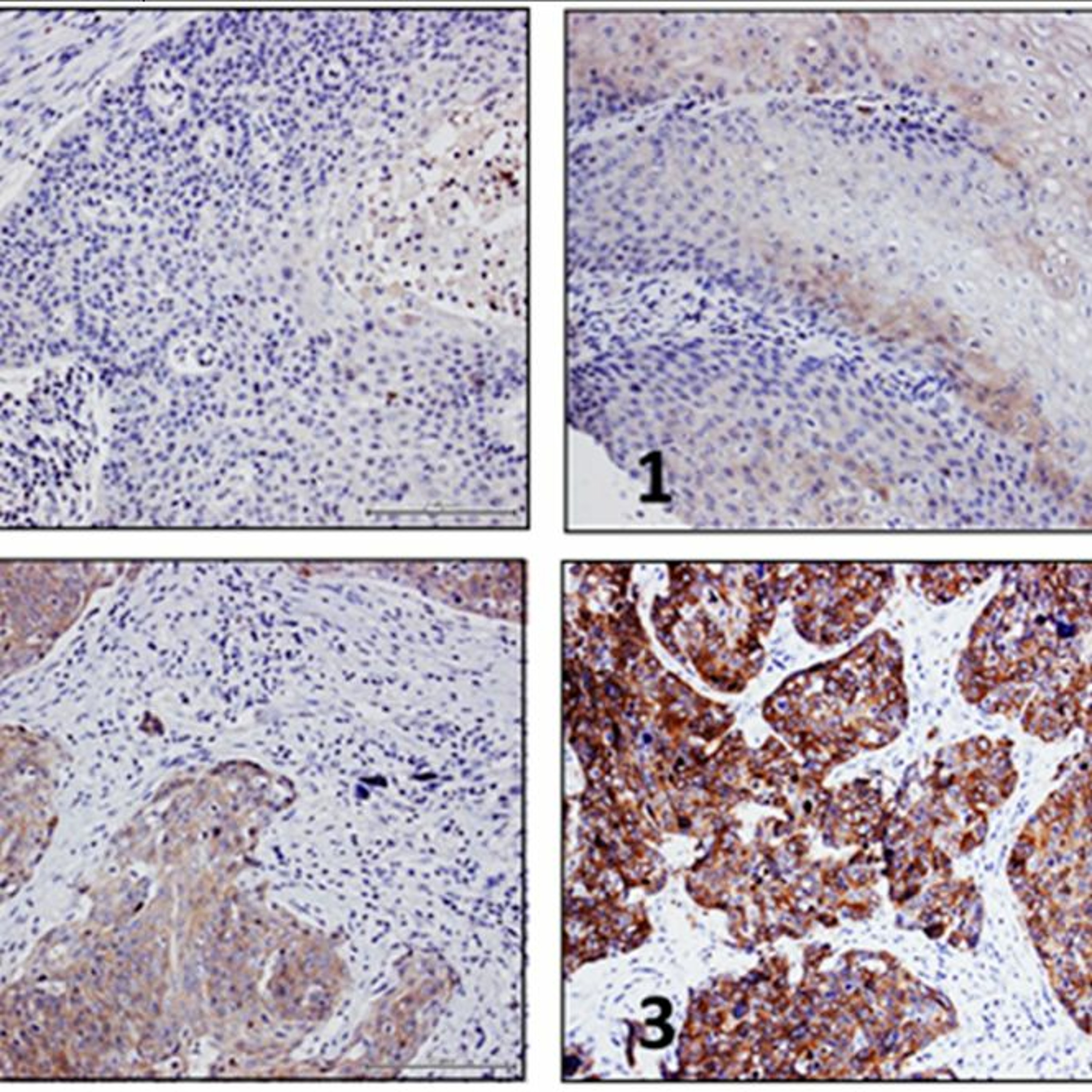 Oncotarget