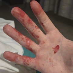 Blood and Bones
