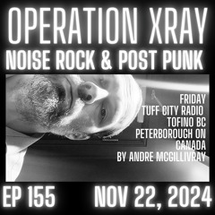 Operation XRAY EP 155 - Nov 22, 2024