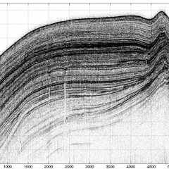 INTRASEK - CARDIOTRACK