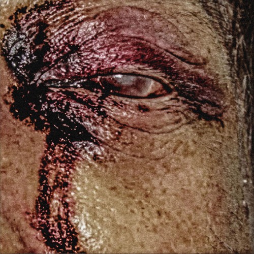 HIDE (MYEN STOKER EDIT)