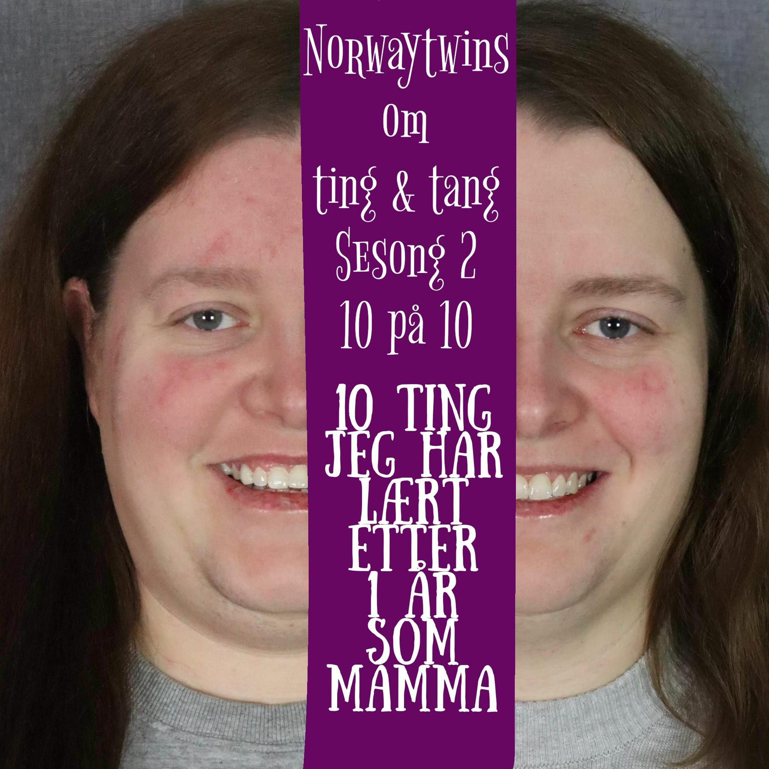 10 på 10 (Sesong 2) Episode 4: 10 Ting Jeg Har Lært Etter Ett År Som Mamma episode artwork