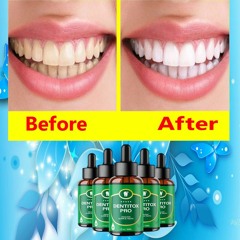 Dentitox Pro Before And After Pictures - Does Dentitox Pro Supplement Really Work Or Not?