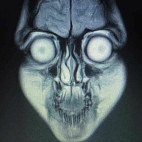 Stream Ugliest Man Alive | Listen to UMA playlist online for free on  SoundCloud