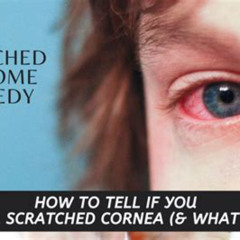 Best Scratched Eye Treatment At Home Reviews