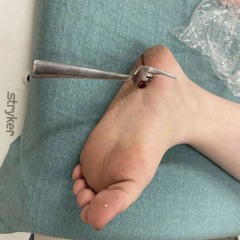 Spontan Ne Gabel Im Fuß[184BPM]