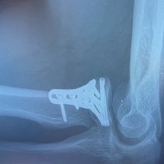 Drama {demo} (feat. Fiveonee) (prod. Istein x fiveonee)